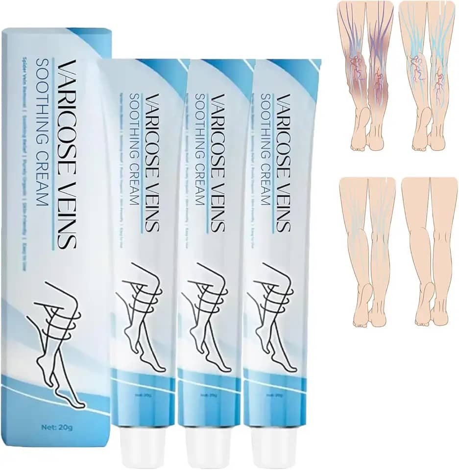 NYYQYYN Tratamento Para Varizes Nas Pernas, Creme - Melhora A Circulação Sanguínea, Reduz O Peso (3 Unidades)